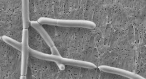 Lactobacillus acidophilus | микробиом | юл иванчей | микробиот | human microbiome