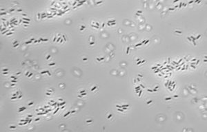 Lactobacillus fermentum | микробиом | юл иванчей | микробиот | human microbiome