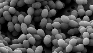 Streptococcus thermophilus | микробиом | юл иванчей | микробиот | human microbiome