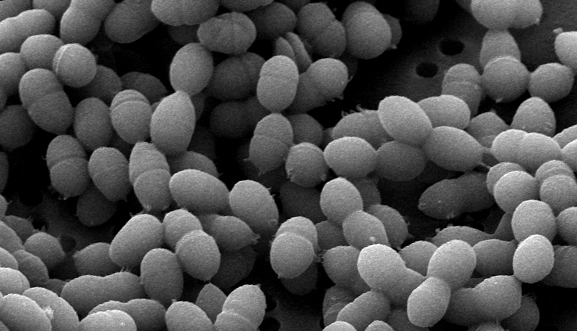 Streptococcus thermophilus | микробиом | юл иванчей | микробиот | human microbiome